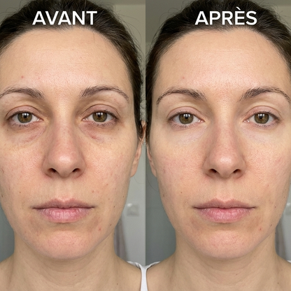 Stick Anti-Cernes & Poches – Contour des Yeux au Rétinol